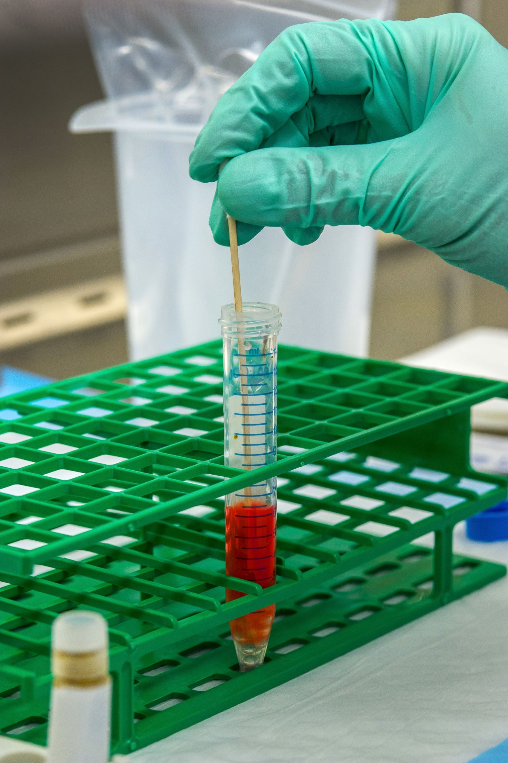Importance of cryopreservation in biobanking